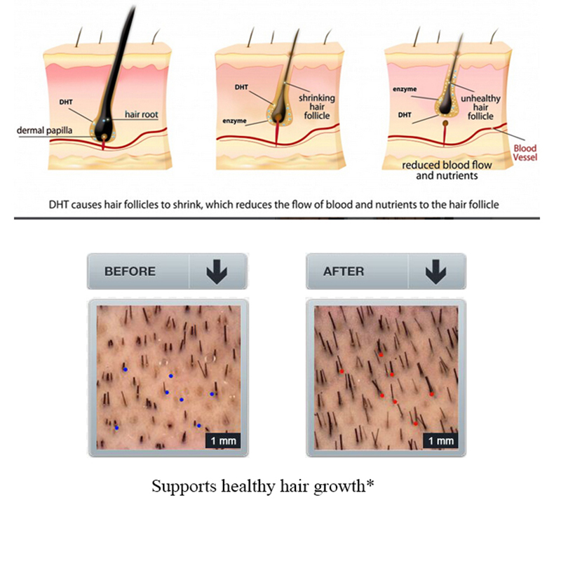 PURC 100ml gingembre perte de  - Licorice Root Sticks avis et prix